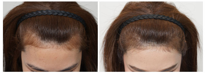 0e5dec309317bcd6eadb986ae4b901d0_1764031215_969.png 0e5dec309317bcd6eadb986ae4b901d0_1764031215_969.png