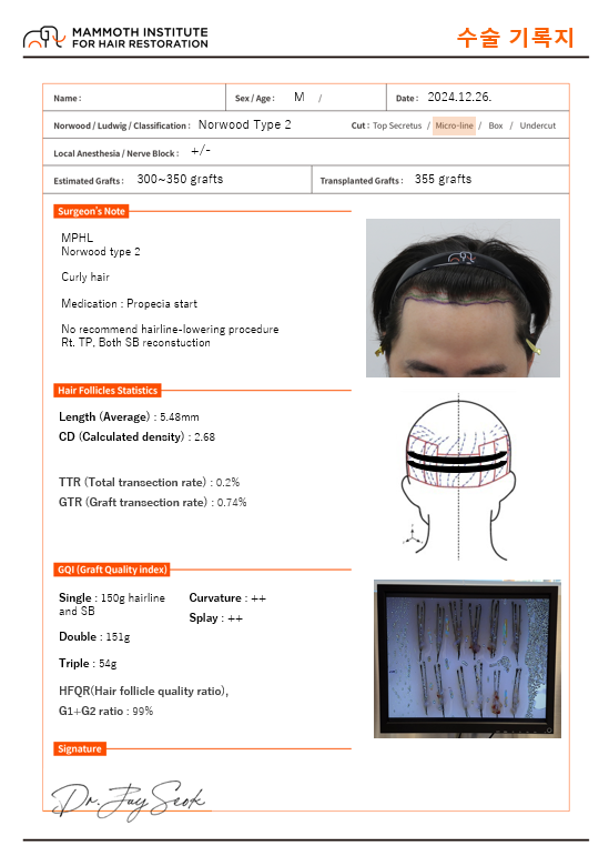 압구정맘모스헤어라인의원석지웅원장님비절개355모낭수술후기