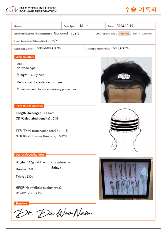 압구정맘모스남다우원장님최소모낭효율이식후기