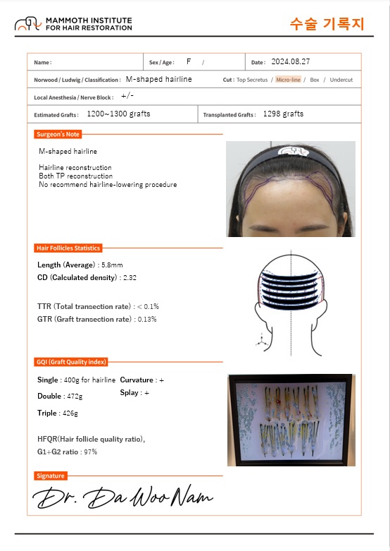 여자M자모발대량수술후기입니다최고감동