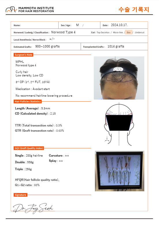 모발이식실패후재수술후기압구정맘모스헤어라인1014모낭3차재수술비절개