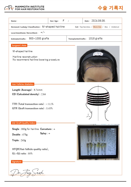 압구정맘모스남다우원장님헤어라인교정모발이식후기