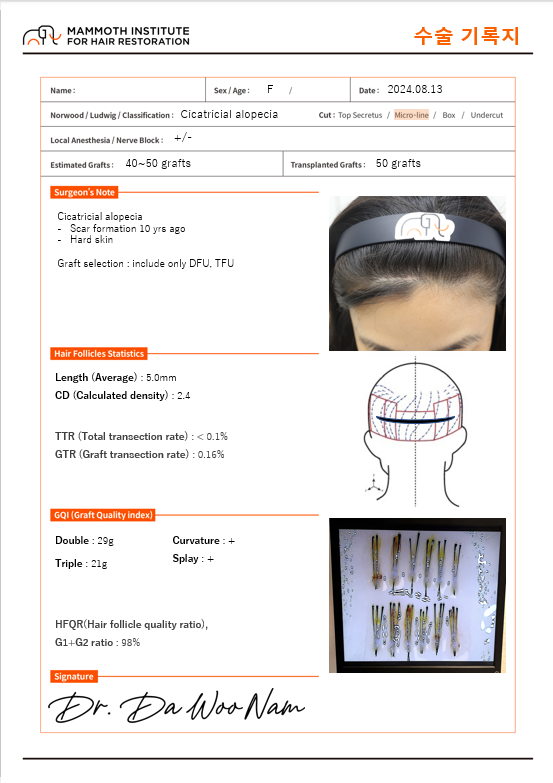 흉터모발이식당일후기압구정맘모스남다우원장님한테비절개로받았어요
