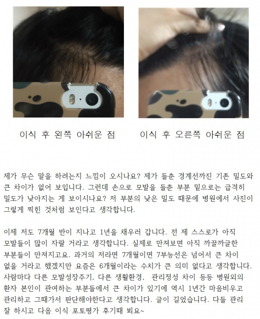 오랜만에뵙습니다뉴헤어7개월후기남깁니다