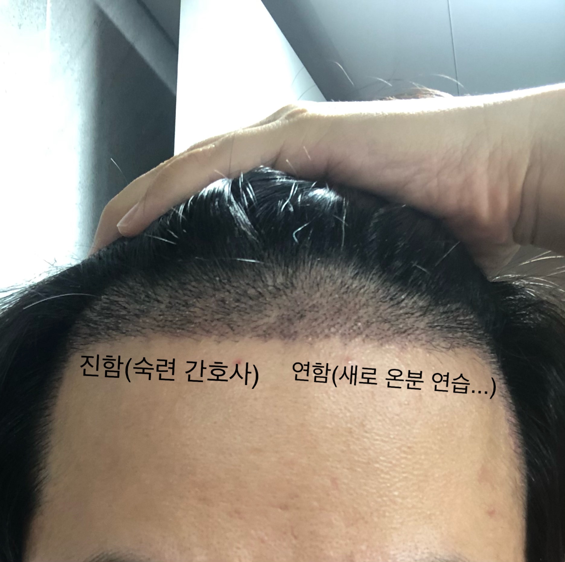 좌우밀도및방향이다르네요ㅠ