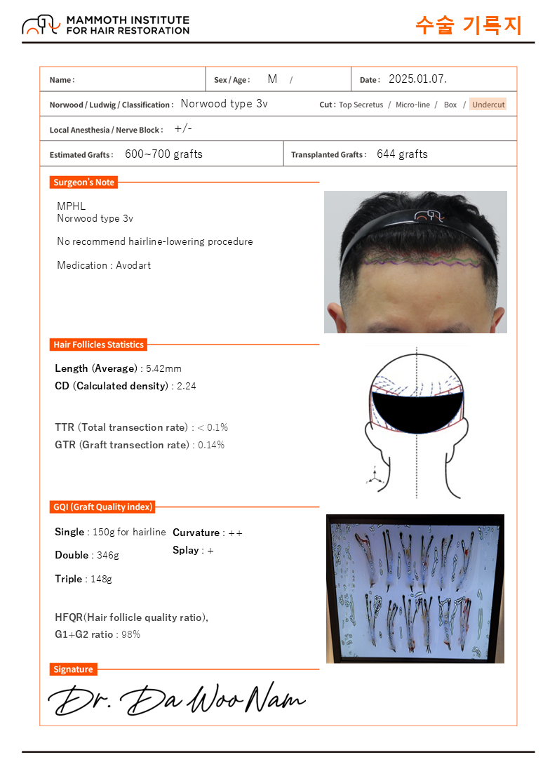 맘모스헤어라인웃음가스마취M자탈모수술당일후기