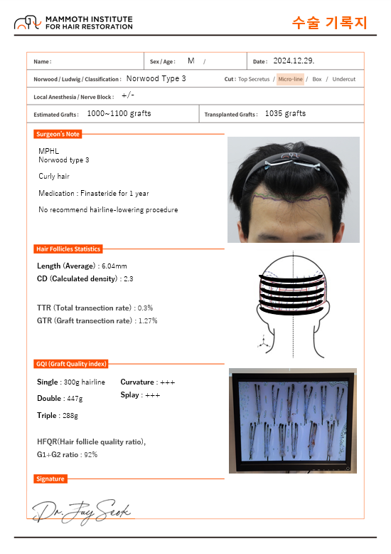 압구정맘모스1035모낭수술1일차후기