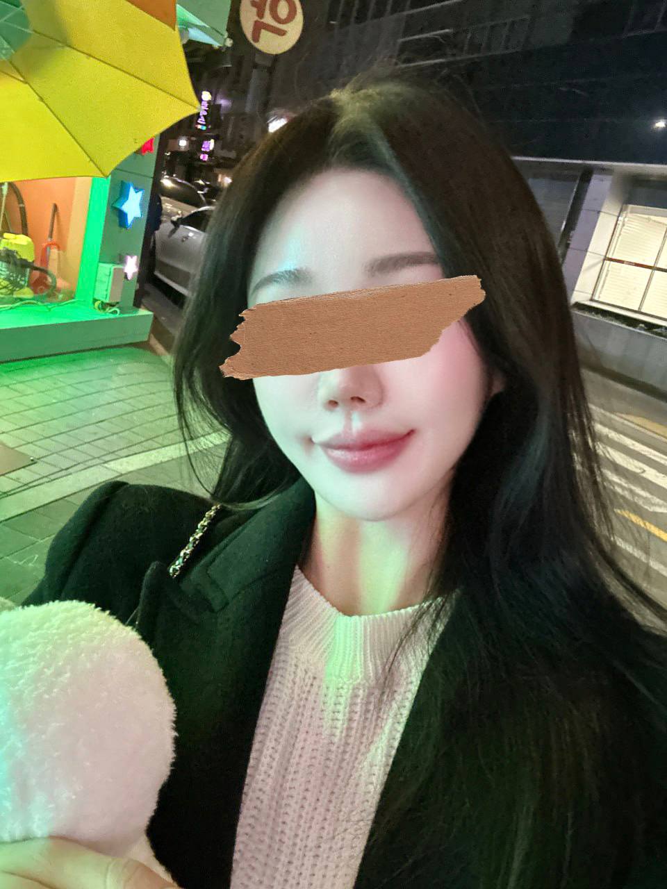 이렇게 머리 내리고 다니면 티 안나요ㅋㅋ 모발이식해서 이마라인이 깔끔하고 동그래졌어요 ♥