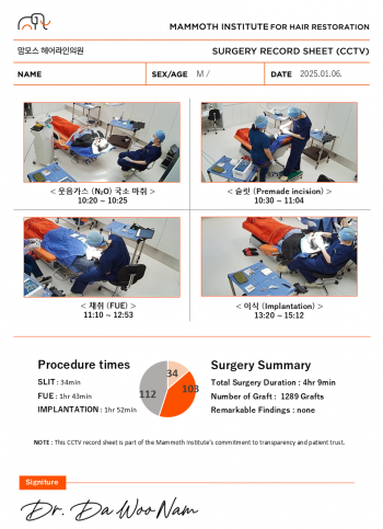 압구정 맘모스 헤어라인의원 웃음가스마취 M자 슬릿 비절개 모발이식 당일 수술 후기