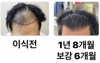 1년 8개월 경과 입니다