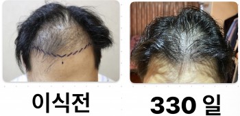 330일경과 되었습니다