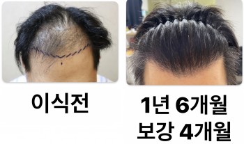 1년 6개월 경과 입니다