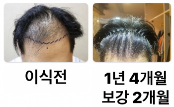 1년 4개월 경과 입니다