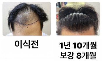 1년 10개월 경과 입니다