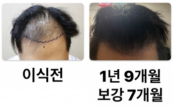 1년 9개월 경과 입니다