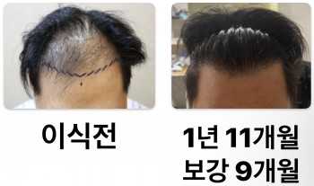 1년 11개월 경과 입니다