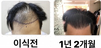 1년 2개월 경과 되었습니다