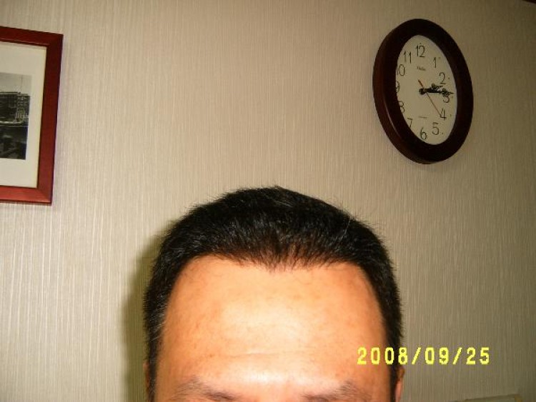 foreheadS3700020.JPG