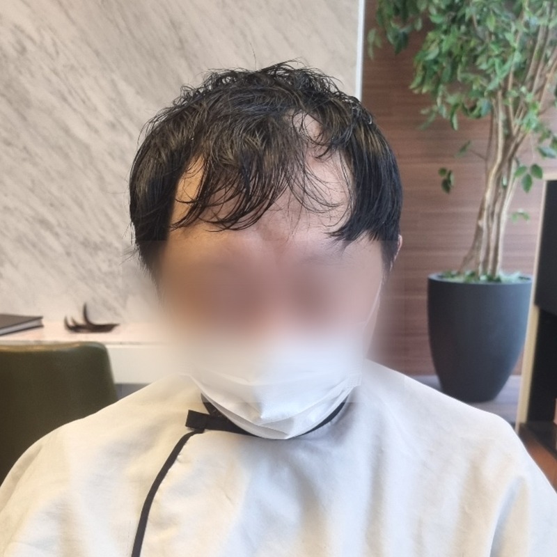 증모술로10년이상젊어보이기있기없기