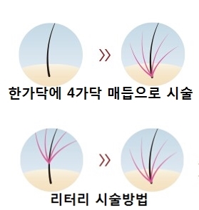 m자이마커버젊어보이기위해방문하신고객님